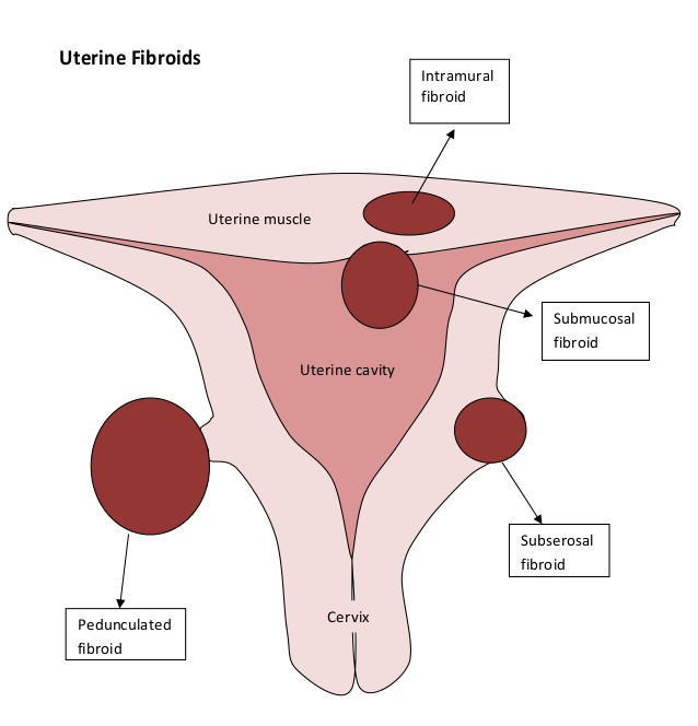 abnormal transvaginal ultrasound